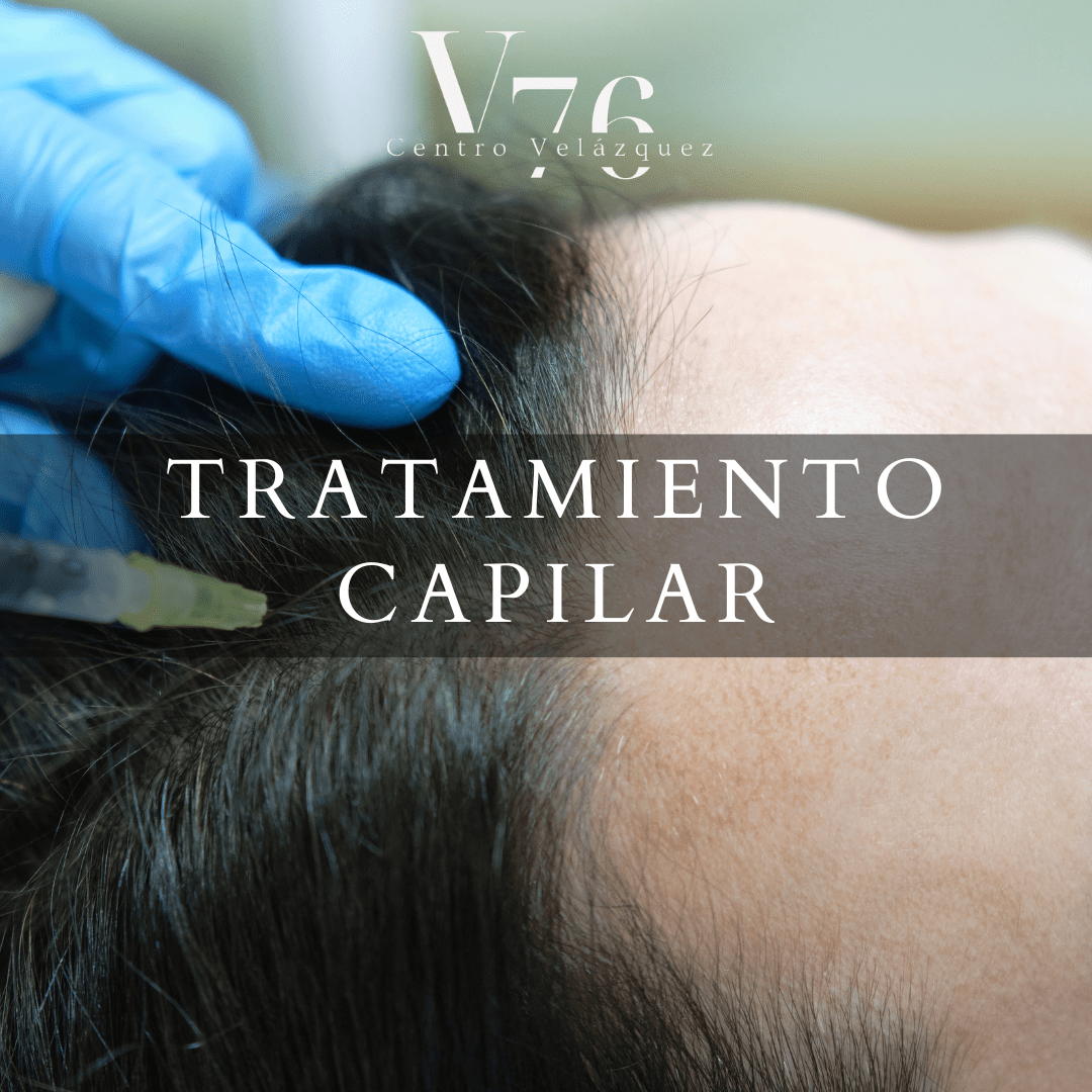 CAPILAR ( ALOPECIA, CAIDA, ESTRES, DENSIDAD, FORTALEZA, POSTINJERTO)