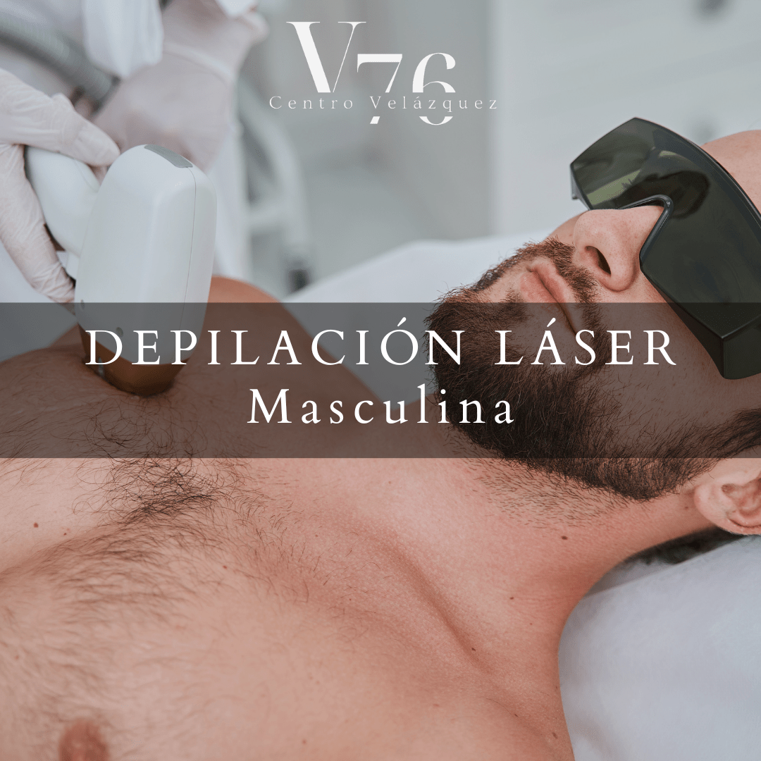 Depilación Láser Masculina