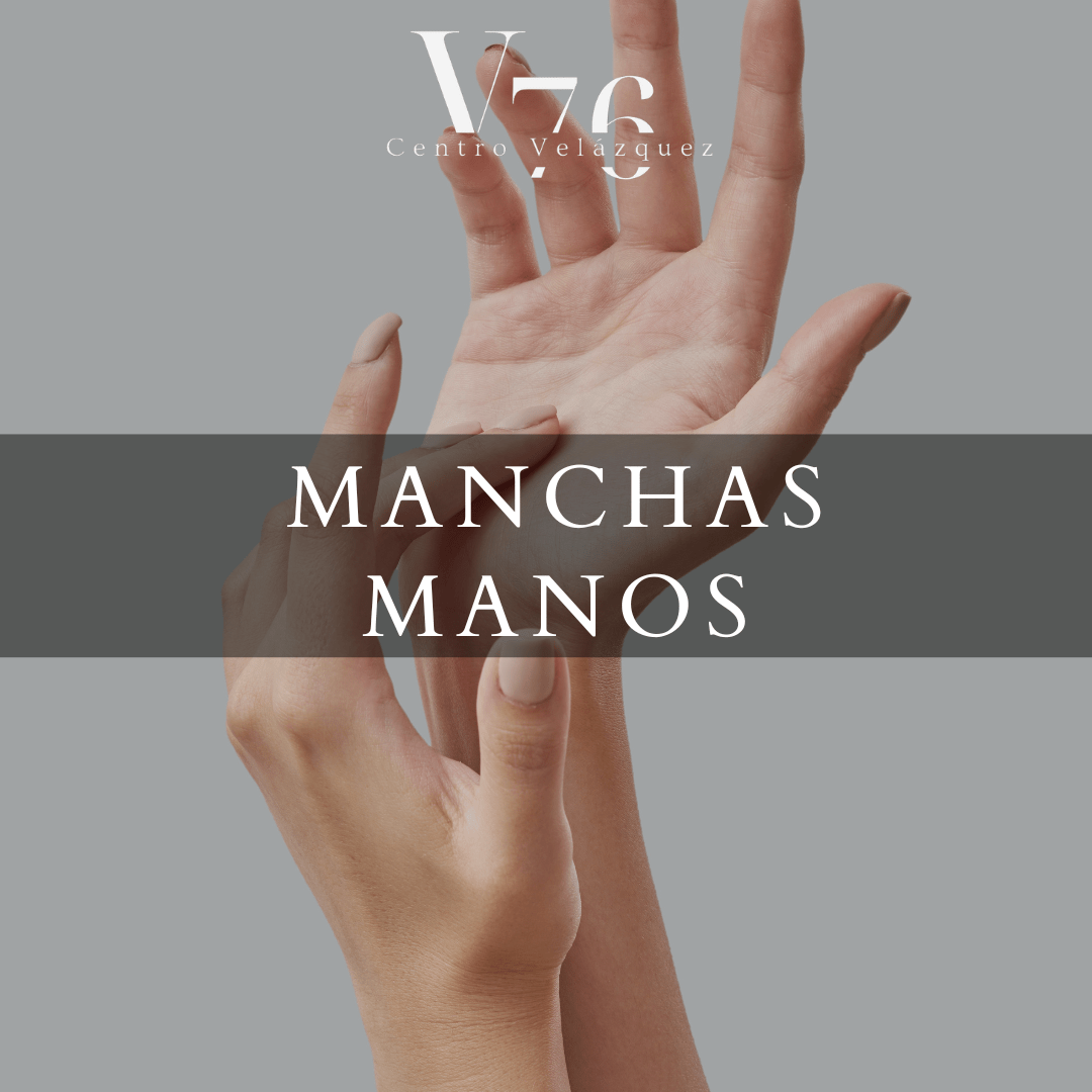 MANOS (MANCHAS, PERDIDA DE DENSIDAD)