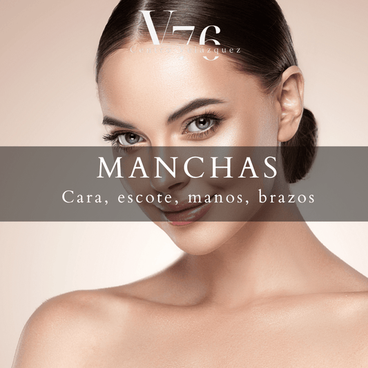 MANCHAS  ( Cara, Escote, Manos, Brazos)