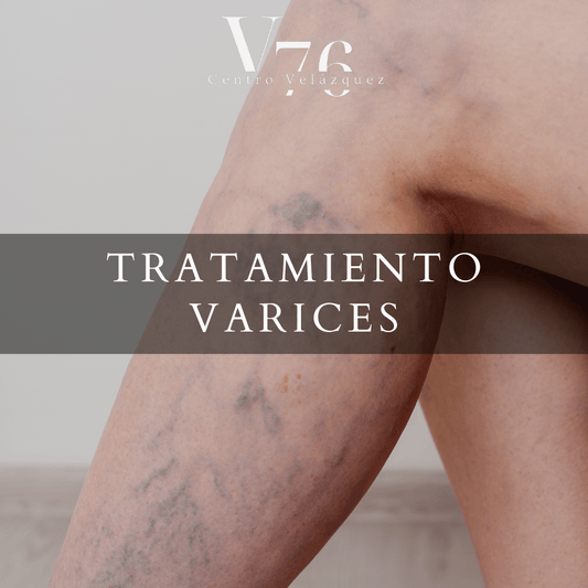 ARAÑAS VASCULARES, DOLOR DE PIERNAS